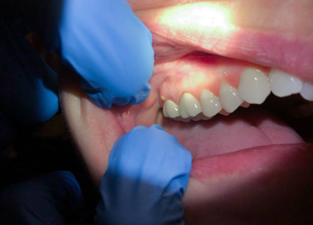 Best Emergency Gum Treatment in Pea Ridge, AR